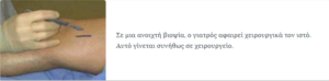 Βιοψία οστού με όγκο